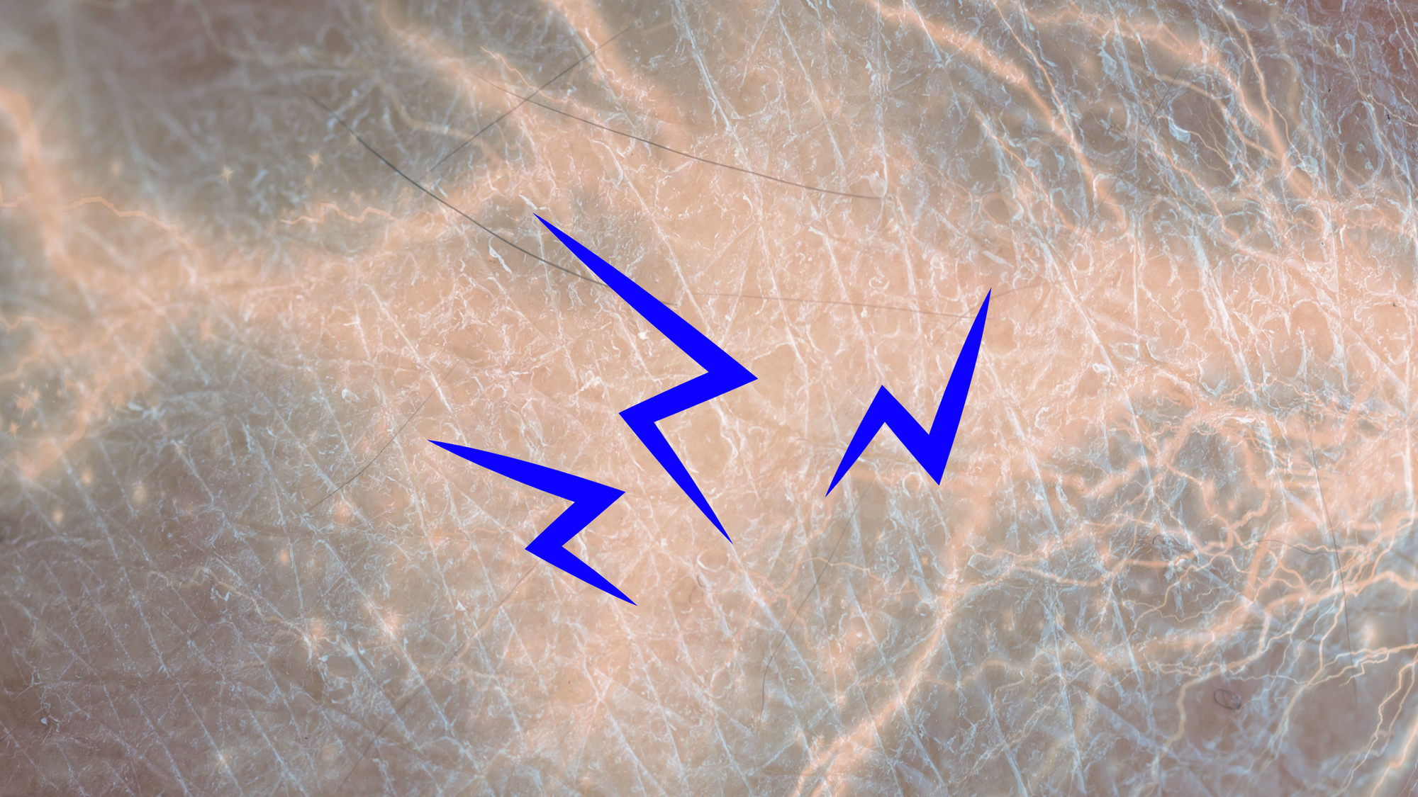 Charge Your Healing: How Electricity Could Revolutionise Wound Care (and Maybe Tattoos Too)