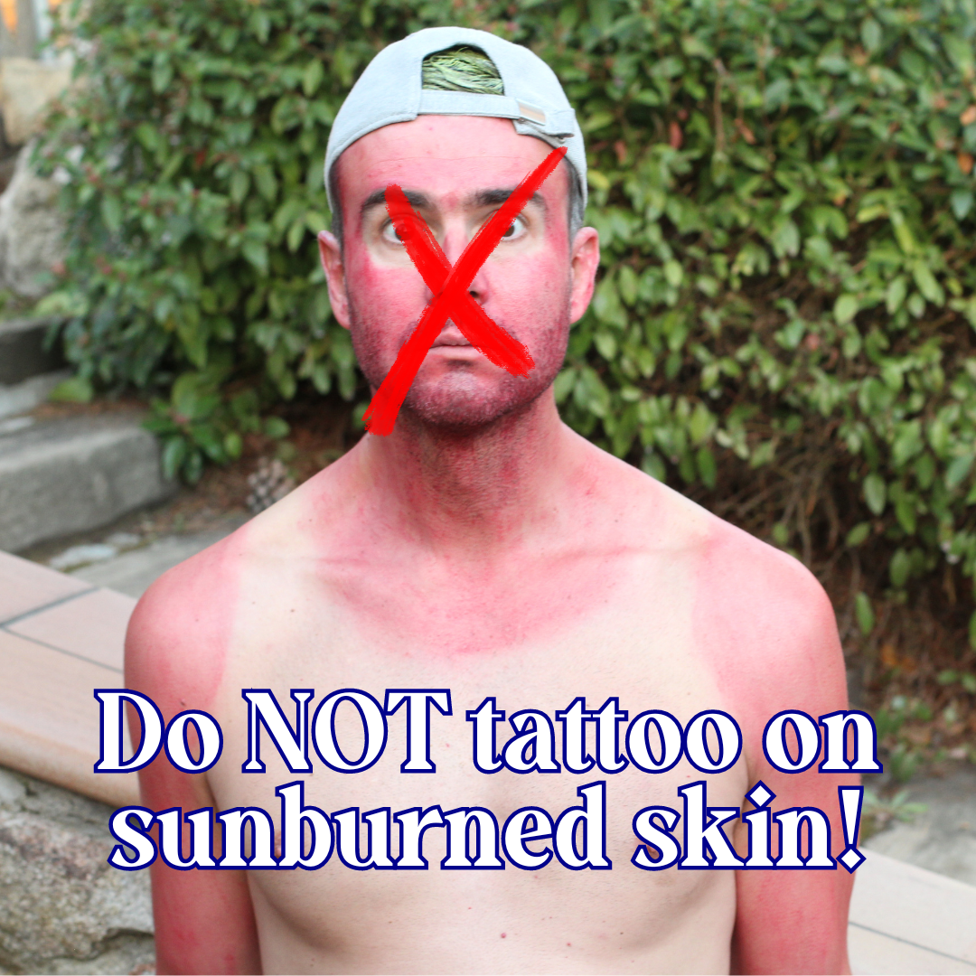 Tattoos AND Sunburn!