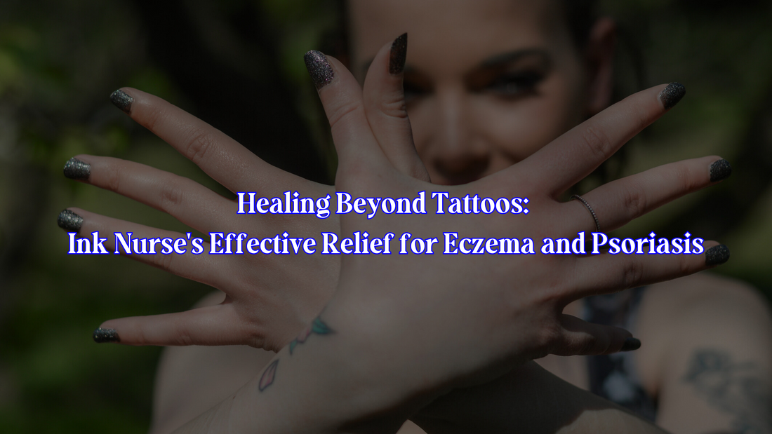 Ink Nurse: Relief for Eczema & Psoriasis Beyond Tattoos