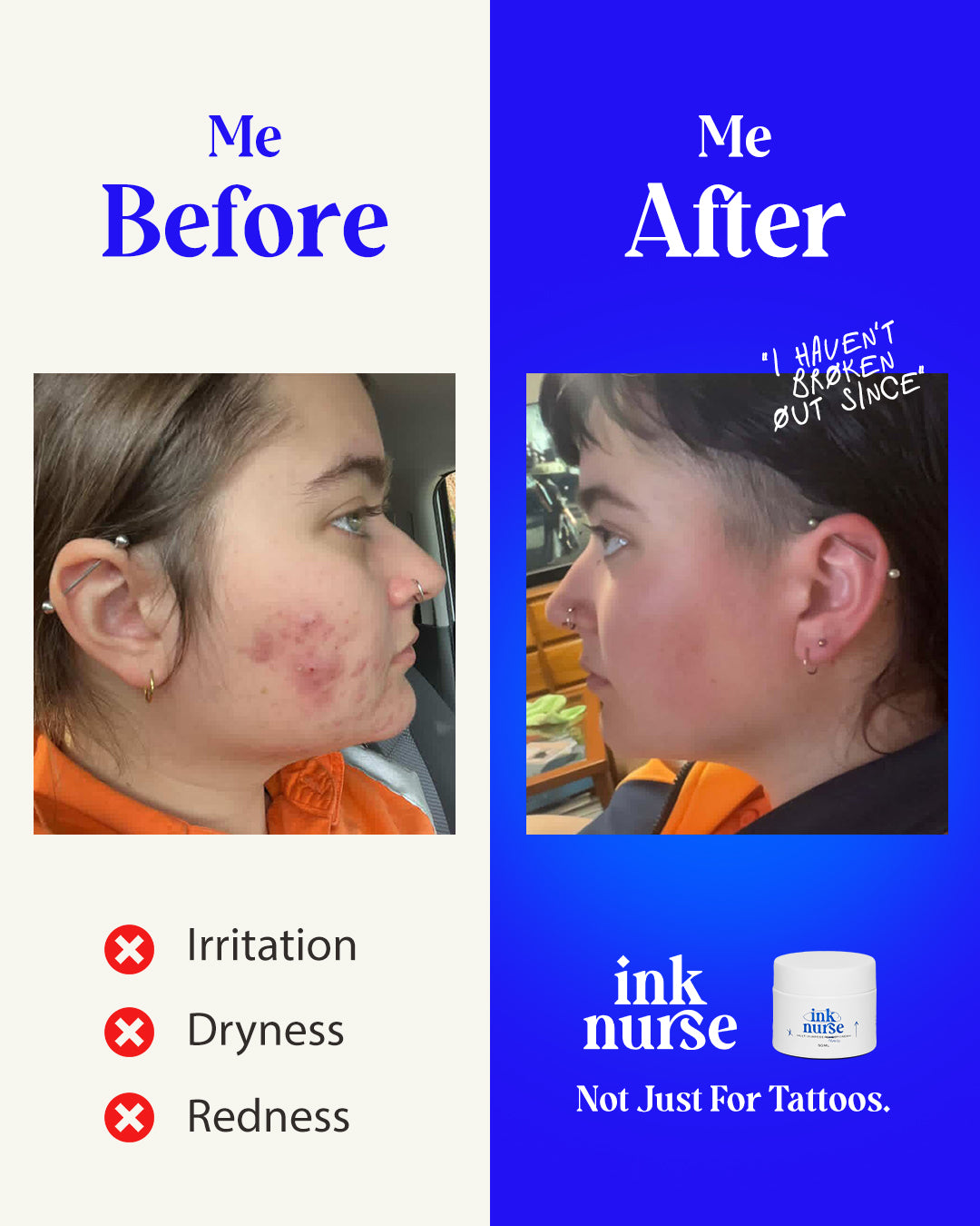 Ink Nurse Tattoo Healing Essentials Kit